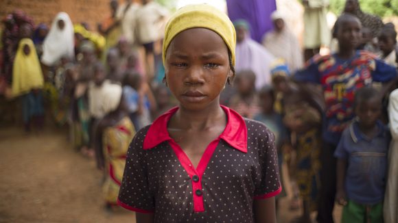 Close up of a young girl with trachoma.