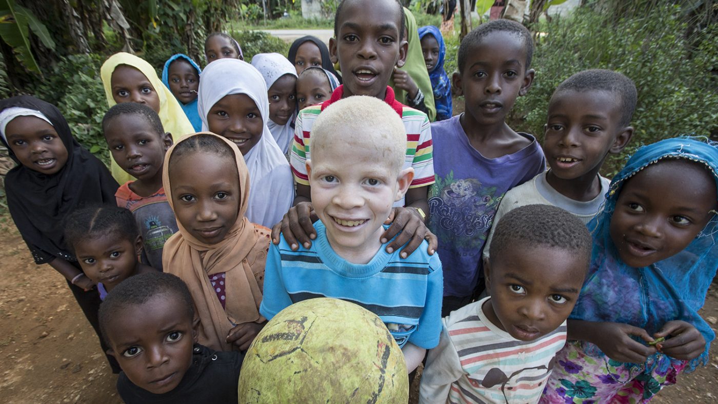 How a radio drama in Malawi is raising awareness of albinism | Blogs | Sightsavers1400 x 788