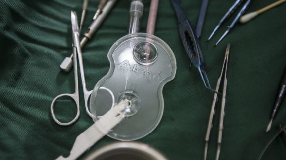 A close-up of surgical tools.
