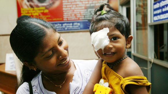 A young toddler smiles with a patch over one eye.