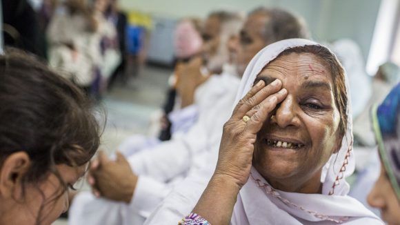 A woman smiles and holds one hand over her eye after successful cataract surgery.
