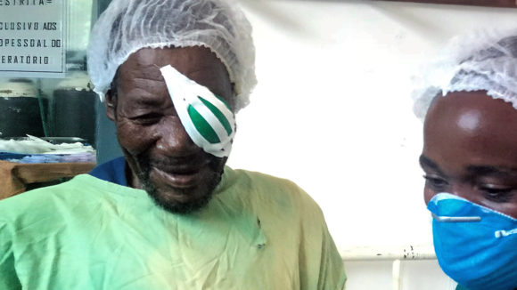 Poligarpo with an eye patch over his eye after his cataract operation.