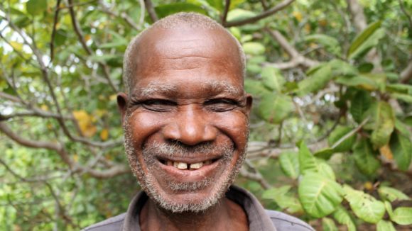 Emmanuel Duako, a man from Ghana, is blind from river blindness. He stands for a portrait outside his fruit farm.