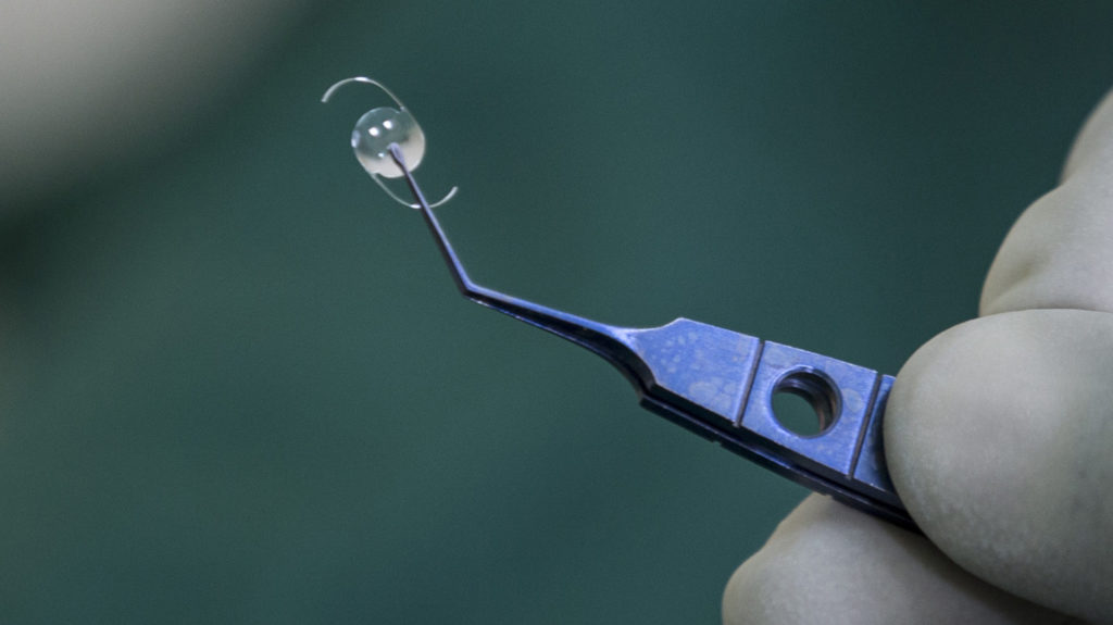 Cataracts in children causes, symptoms and surgery Sightsavers