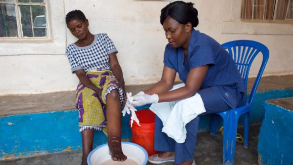 A nurse helps wash a woman who has lymphatic filariasis wash her swollen leg.