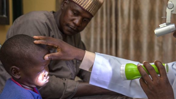Muzi's eyes are examined with a torch after his eye surgery