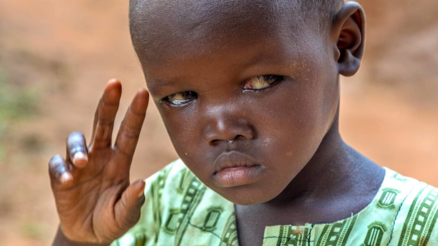 Muzi looking away from the camera with his hand reaching to his right eye.