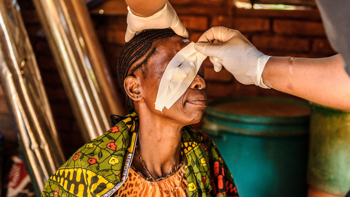 A doctor peeling a bandage off Fatuma's right eye.