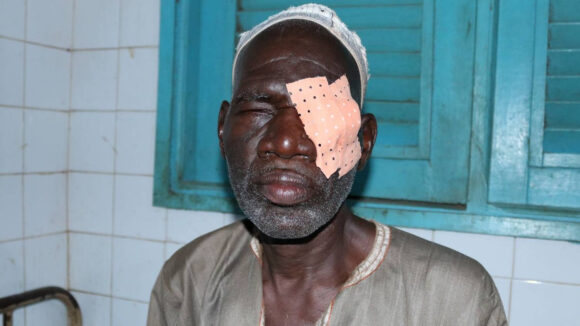 Ouedraogo with a bandage over his left eye.