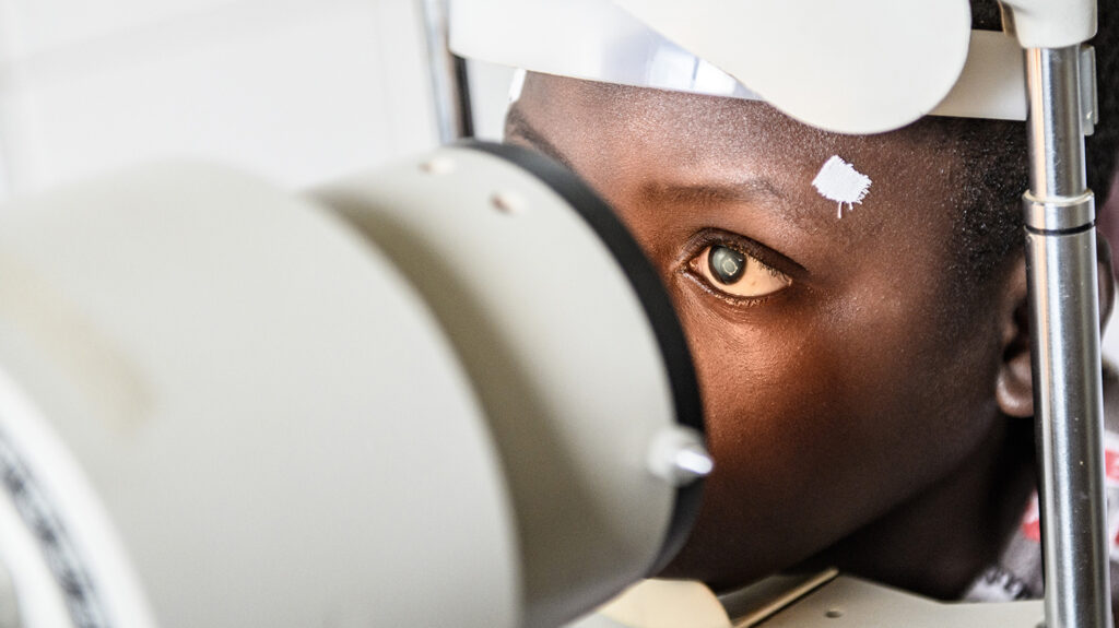 Cataracts in children causes, symptoms and surgery Sightsavers