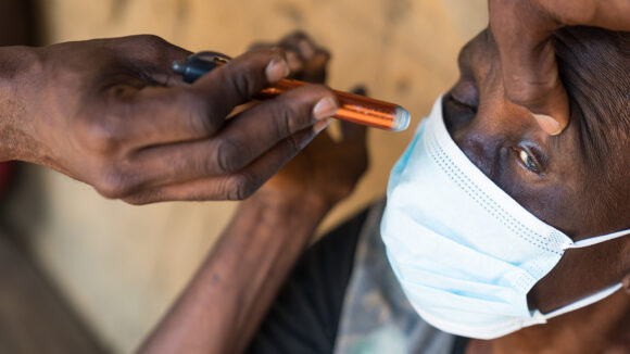 A close-up of an eye health worker's hands as he shines a light into a patient's eyes to check for signs of trachoma.