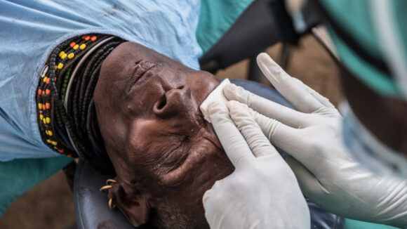 A male patient undergoes trachoma surgery.
