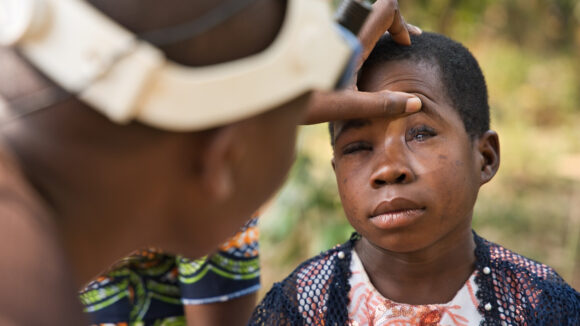 Samantha, a nine-year-old girl, has her eye examined after an operation for advanced trachoma.