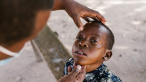 Mohamed looks up with his eyes open while his eyes are being examined
