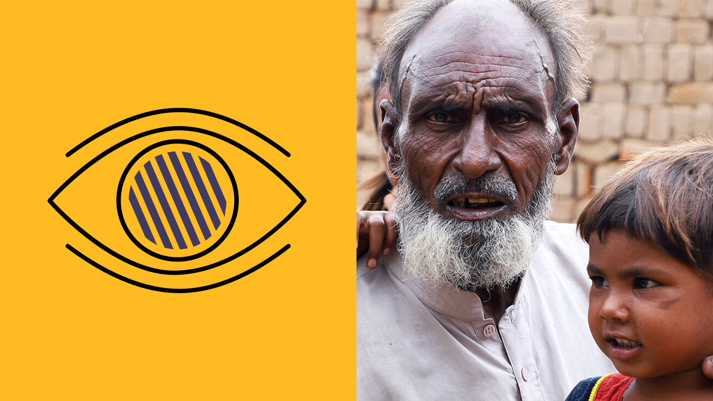 Cataracts causes symptoms and treatment sightsavers