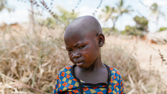 A young girl, Mwamini, stands outside, squinting in pain. Her eyes are weeping.